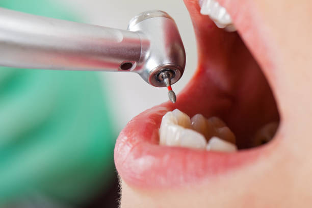 Best Emergency Treatment for Dental Infections or Abscesses in Augusta, KY